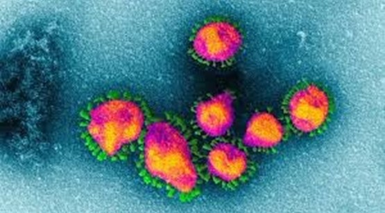 Corona-Virus: OB Horn bittet um Besonnenheit: „Das Virus ist ein Grund zur Vorsicht, aber kein Grund zur Panik“